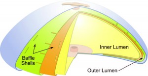 IDEAL Structured Breast IMPLANT Baffles