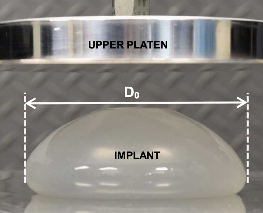 Ideal Breast Implant